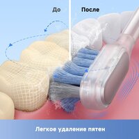 Электрическая зубная щетка Trouver 3D Clean Electric Toothbrush ATB15A (серебристый) - Превью изображения №9 — Мульти e-магазин M-SELL
