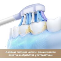 Электрическая зубная щетка Trouver Fresh 20 NE0 Electric Toothbrush ATB23B (белый) - Превью изображения №11 — Мульти e-магазин M-SELL